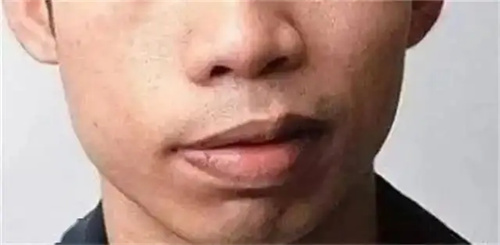 图片细节说明